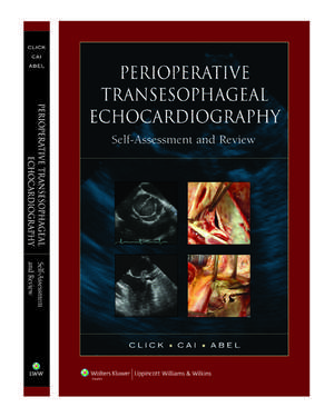 Perioperative Transesophageal Echocardiography Self-Assessment and Review de Roger L. Click MD, PhD, FACC