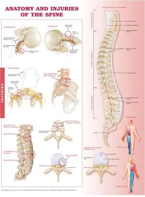 Anatomy and Injuries of the Spine: Anatomical Chart de Anatomical Chart Company