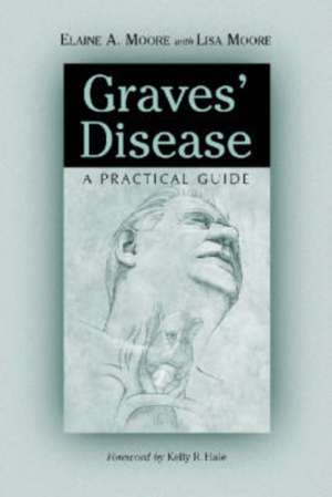 Graves' Disease: A Practical Guide de Elaine A. Moore