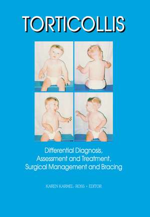 Torticollis: Differential Diagnosis, Assessment and Treatment, Surgical Management and Bracing de Karen Karmel-Ross