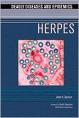 Herpes de Juliet V. Spencer