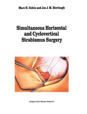 Simultaneous Horizontal and Cyclovertical Strabismus Surgery de M.H. Gobin