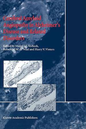 Cerebral Amyloid Angiopathy in Alzheimer’s Disease and Related Disorders de M.M. Verbeek