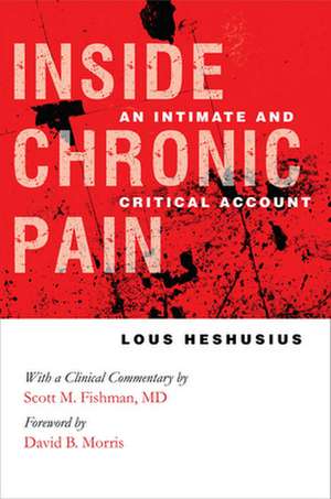 Inside Chronic Pain – An Intimate and Critical Account de Lous Heshusius