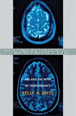 Magnetic Appeal – MRI and the Myth of Transparency de Kelly Joyce