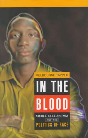 In the Blood – Sickle Cell Anemia and the Politics of Race de Melbourne Tapper