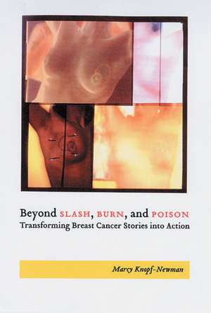 Beyond Slash, Burn, and Poison: Transforming Breast Cancer Stories into Action de Marcy Knopf-Newman