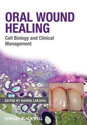 Oral Wound Healing – Cell Biology and Clinical Management de H Larjava