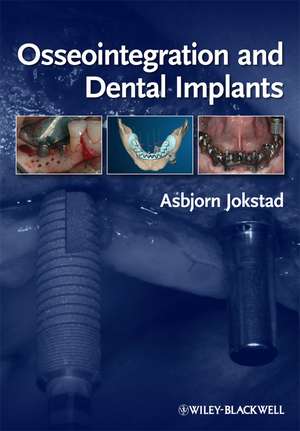 Osseointegration and Dental Implants de A Jokstad