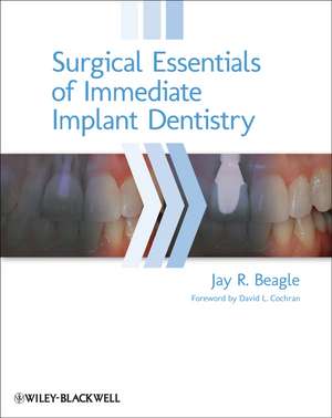 Surgical Essentials of Immediate Implant Dentistry de J Beagle