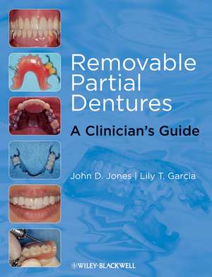 Removable Partial Dentures de LT Garcia