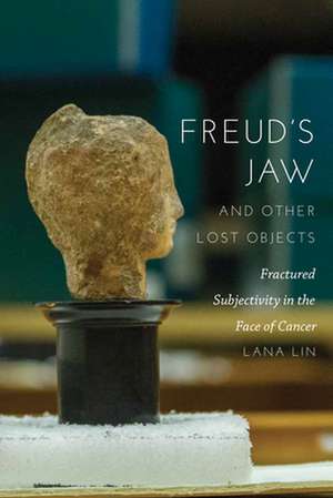 Freud`s Jaw and Other Lost Objects – Fractured Subjectivity in the Face of Cancer de Lana Lin