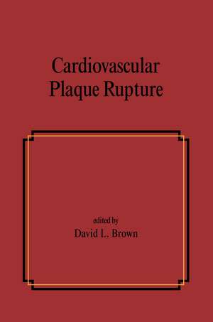 Cardiovascular Plaque Rupture de David L. Brown