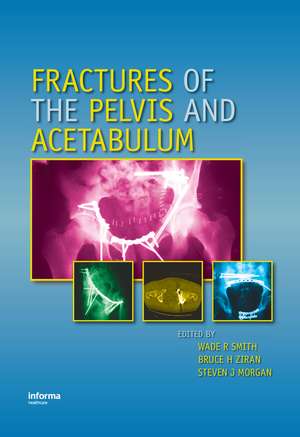 Fractures of the Pelvis and Acetabulum de Wade R. Smith