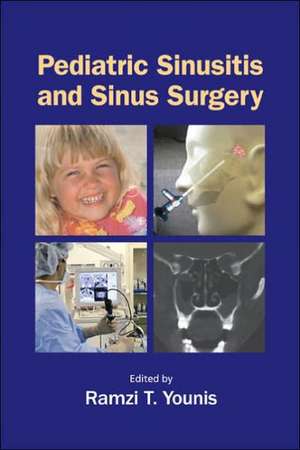 Pediatric Sinusitis and Sinus Surgery de Ramzi T. Younis