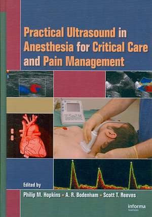 Practical Ultrasound in Anesthesia for Critical Care and Pain Management de Philip M. Hopkins