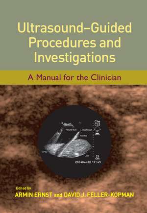 Ultrasound-Guided Procedures and Investigations: A Manual for the Clinician de Armin Ernst