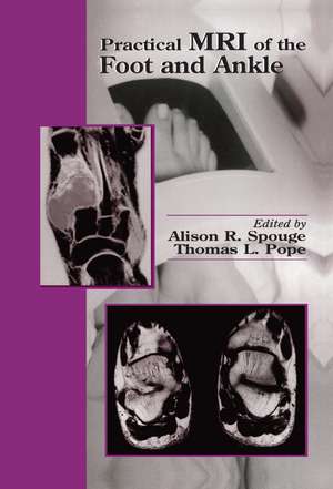 Practical MRI of the Foot and Ankle: Methods and Applications de Alison R. Spouge