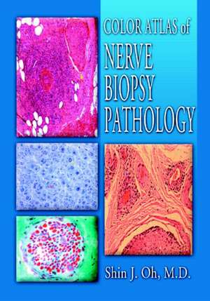 Color Atlas of Nerve Biopsy Pathology de Shin J. Oh