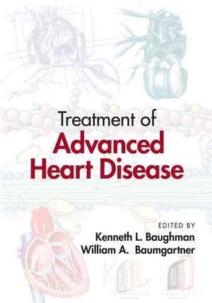 Treatment of Advanced Heart Disease de Kenneth L. Baughman