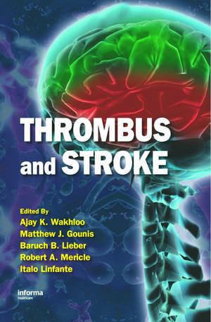 Thrombus and Stroke de Ajay K. Wakhloo