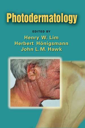 Photodermatology de Henry W. Lim