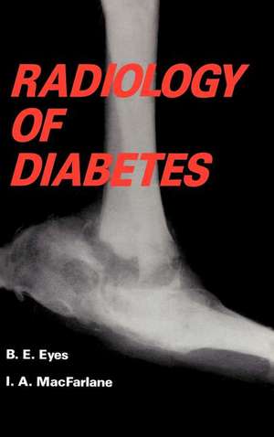 Radiology of Diabetes de B. Eyes