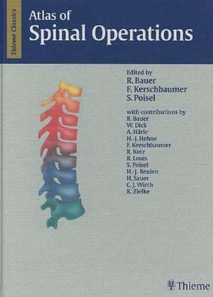 Atlas of Spinal Operations de R. Bauer