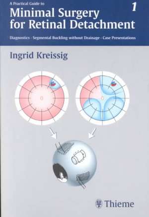 A Practical Guide to Minimal Surgery for Retinal Detachment de Ingrid Kreissig