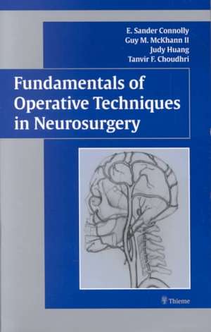 Fundamentals of Operative Techniques in Neurosurgery de E. Connolly