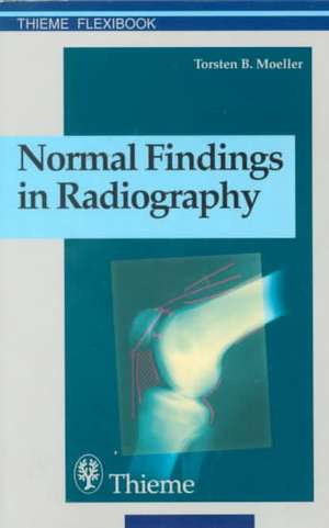 Normal Findings in Radiography de Torsten Bert Moeller