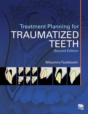 Treatment Planning for Traumatized Teeth de Mitsuhiro Tsukiboshi