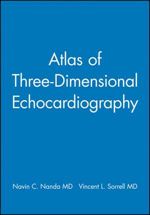 Atlas of Three–Dimensional Echocardiography de Navin C. Nanda