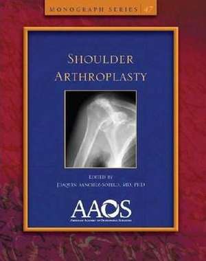 Shoulder Arthroplasty de SANCHEZ-SOTELO