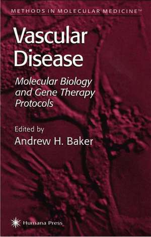 Vascular Disease: Molecular Biology and Gene Transfer Protocols de Andrew H. Baker