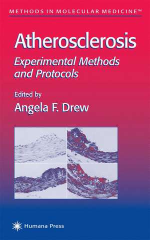 Atherosclerosis: Experimental Methods and Protocols de Angela F. Drew