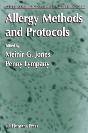 Allergy Methods and Protocols de Meinir G. Jones