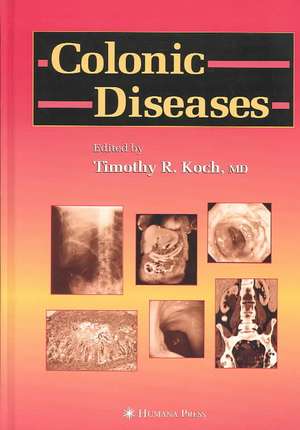 Colonic Diseases de Timothy R. Koch