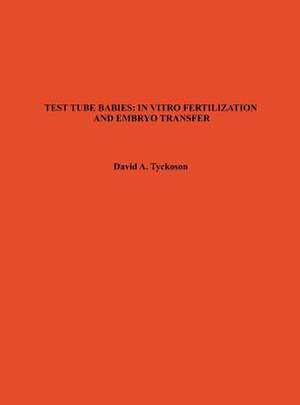 Test Tube Babies: In Vitro Fertilization and Embryo Transfer de Tyckoson