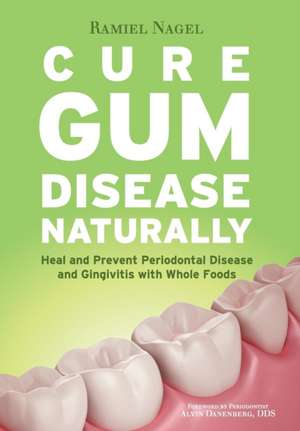 Cure Gum Disease Naturally de Ramiel Nagel