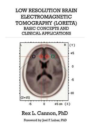 Low Resolution Brain Electromagnetic Tomography (Loreta): Basic Concepts and Clinical Applications de Rex Cannon