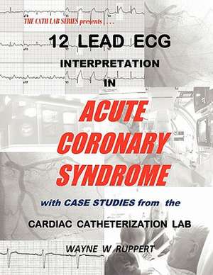 12 Lead ECG Interpretation in Acute Coronary Syndrome with Case Studies from the Cardiac Catheterization Lab de Wayne W Ruppert