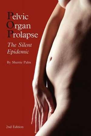 Pelvic Organ Prolapse de Sherrie J Palm