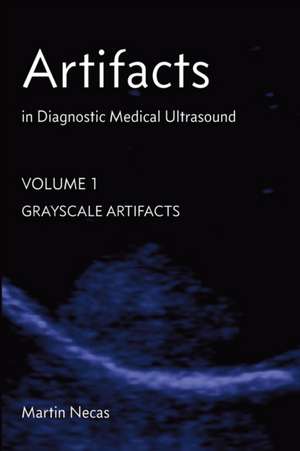 Artifacts in Diagnostic Medical Ultrasound de Martin Necas