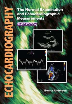 Echocardiography