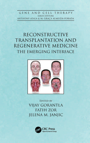 Reconstructive Transplantation and Regenerative Medicine: The Emerging Interface de Vijay Gorantla