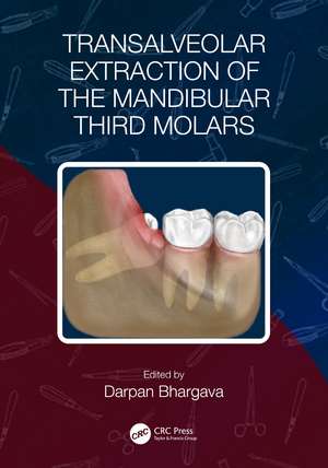 Transalveolar Extraction of the Mandibular Third Molars de Darpan Bhargava