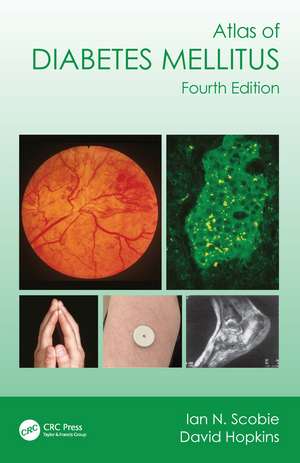 Atlas of Diabetes Mellitus de Ian N. Scobie