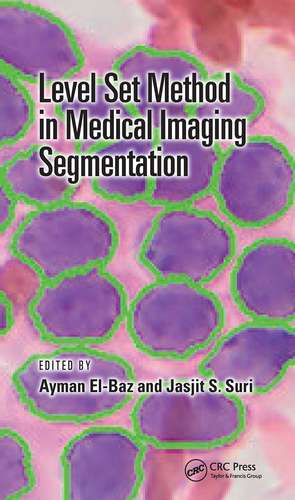 Level Set Method in Medical Imaging Segmentation de Ayman El-Baz