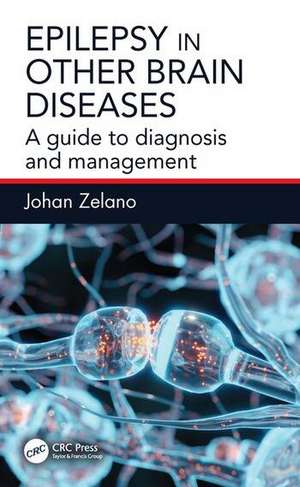 Epilepsy in Other Brain Diseases de Johan Zelano